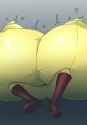 Breast_expansion_3