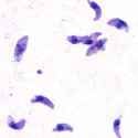 Toxoplasma_gondii_tachy