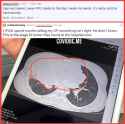 NataschaTata Reddit COVID-19 Vaccine Vaxx Jab Injuries Tumor Turbo Cancer