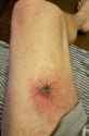 Ouch!