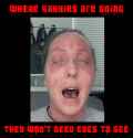 COVID-19 Vaccine Vaxx Jab Injuries mudbloods--EVENT_HORIZON Eyes Blind