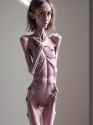 562 KB