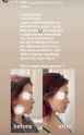 1.09 MB