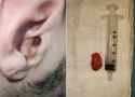 87 KB