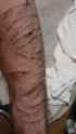 927 KB