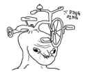 brainlet