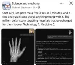 99 KB