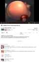 viral_expansion_by_kidquetzal-d5qmr3x