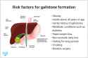 risk-factors-for-gallstone-formation