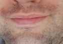 face