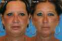 case-medical_study_photo_of_smok