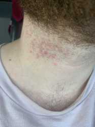 neck