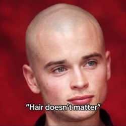 /balding/ general