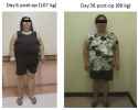 Pattern of Weight Loss after Successful Enucleation of an Insulin-producing Pancreatic Neuroendocrine Tumor