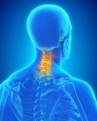 Neck pain