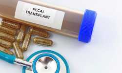 fecal_transpl