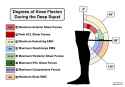degrees_knee_flexion