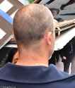 99405491-14815285-The_Hollywood_star_showed_signs_of_hair_loss_with_a_bald_patch_v-m-16_1750054572255