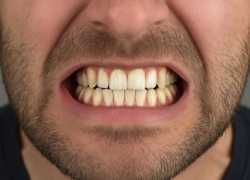 129 KB