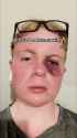 1.51 MB