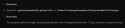 32 KB