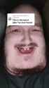 515 KB