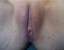 robyn-labiacut-fgm-female-circumcision-bloody-012