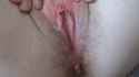 f8771776