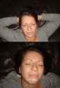 Before___After_facial