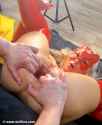 CWS-anal-gape5