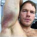 3B6A820700000578-0-Eek_Chris_Pratt_exposed_some_nasty_bruises_on_his_arms_that_he_r-m-19_1481826705683