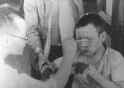 Boy_being_treated_for_burns_of_the_face_and_hands_in_Hiroshima_Red_Cross_Hospital