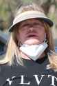 Goldie-Hawn-botched-plastic-surgery-