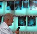 x-rays