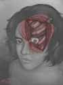 Displacia
