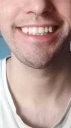 smile