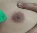 1000029306