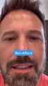 20 KB