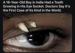 162 KB