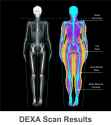 dexa-scaled