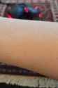 arm hair