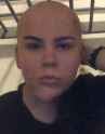 bald