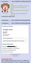 374 KB