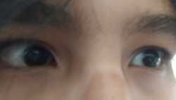Eye thread