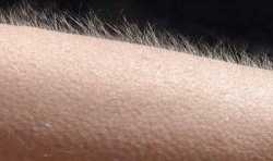 Goose_Bumps