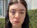 lorde-worries-fans-photos-bruised-black-eye-deleting-instagram-posts-1-1727725238651