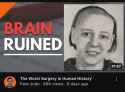 brain ruined (2)