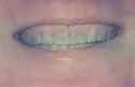 teeth1