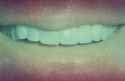 teeth4