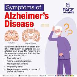 Symptoms+of+Alzheimer-s+disease+-+PACE+Hospitals-640w